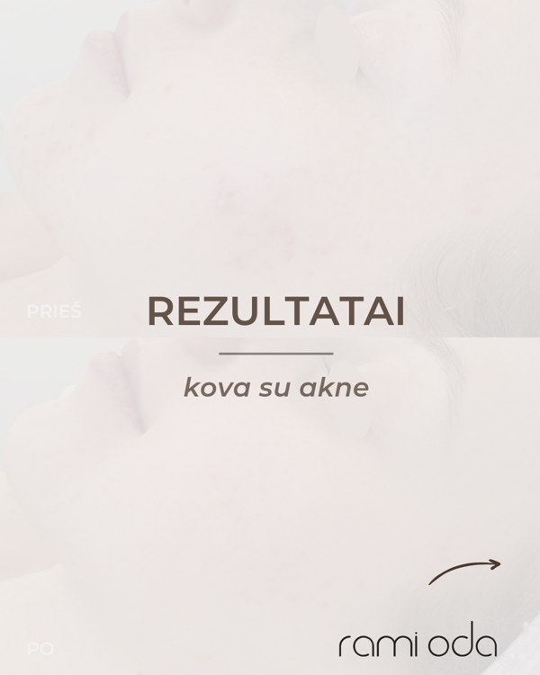 Kosmetologės Kaune Ramintos Tamulaitės instagram įrašas