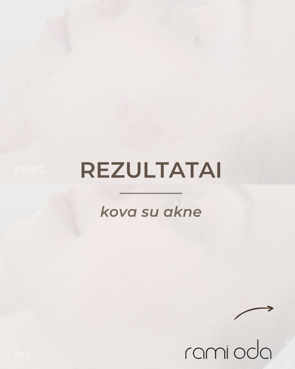 Kosmetologės Kaune Ramintos Tamulaitės instagram įrašas